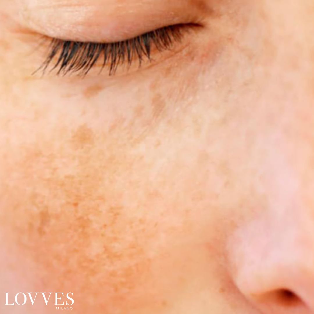 Siero Schiarente Macchie Viso Depigmentante