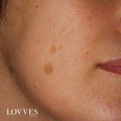 Siero Schiarente Macchie Viso Depigmentante