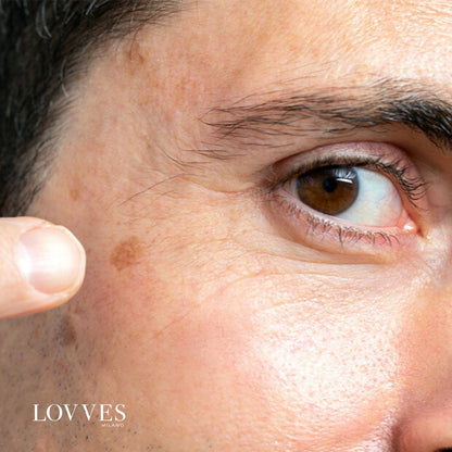 Siero Schiarente Macchie Viso Depigmentante